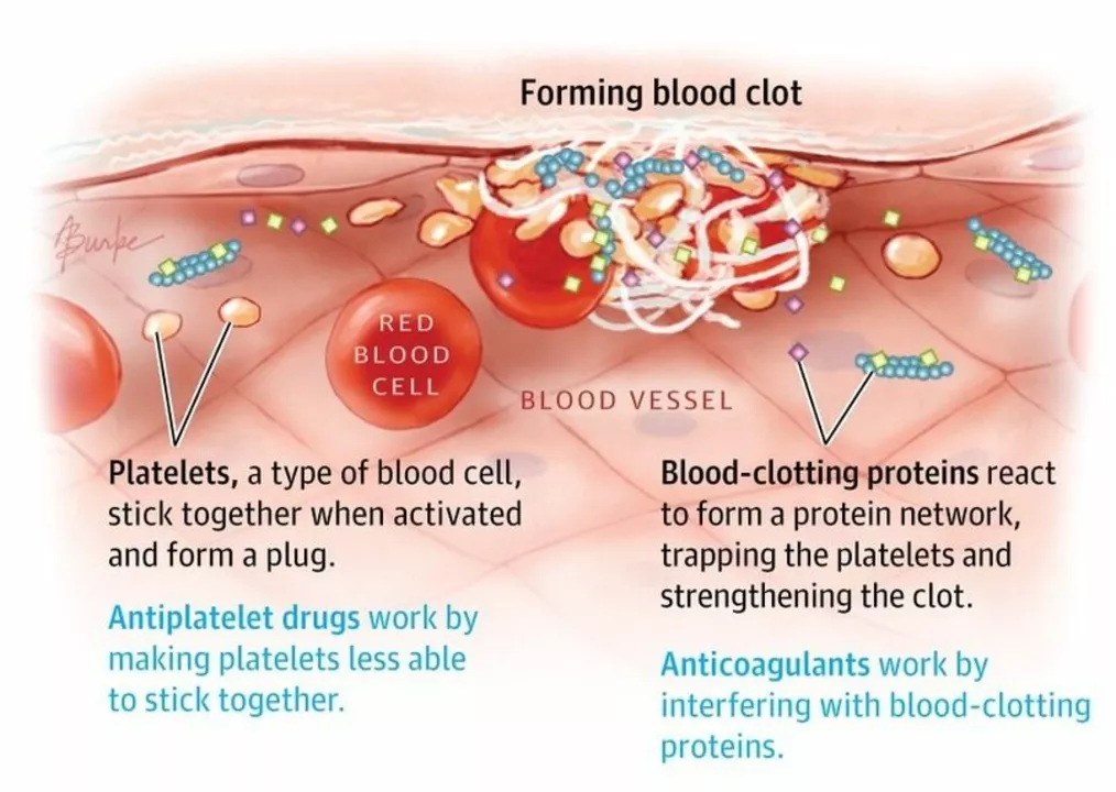Addressing Concerns About Drospirenone and Blood Clot Risks