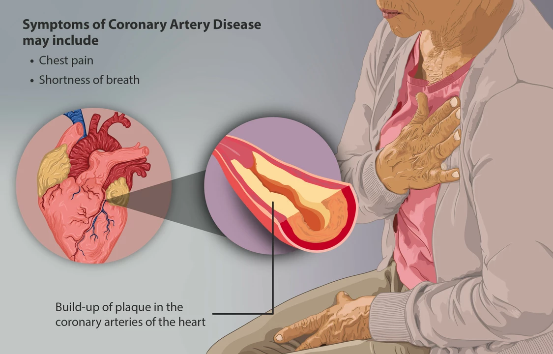 The Benefits of Exercise in Managing and Preventing Coronary Artery Disease